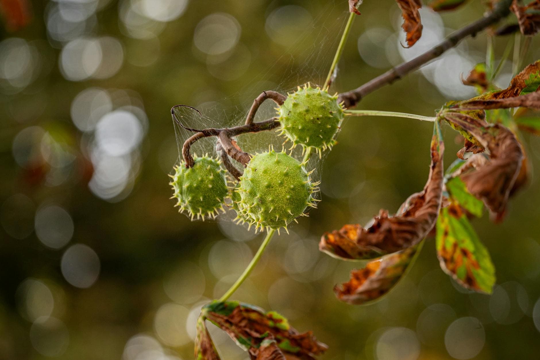 Varicocele: ¿Cómo Reconocer las Venas Testiculares Dilatadas y su Malestar?