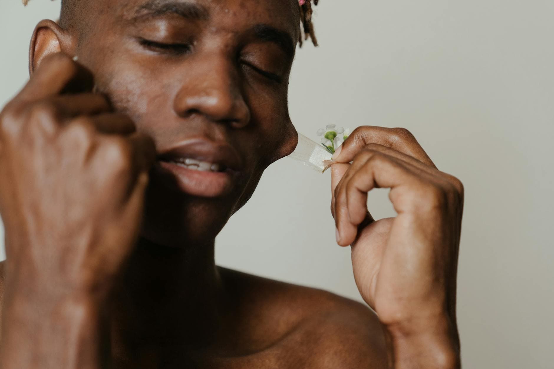 Manejo Natural del Acné: Entiende Sus Causas y Cuida Tu Piel